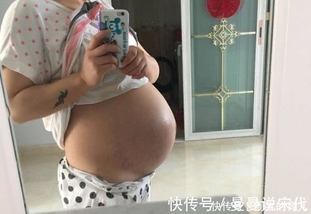 妊娠|晚孕肚子痒，可能暗示这一征兆，准妈妈别疏忽