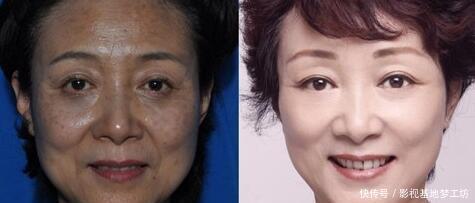 肌肤|蜂蜜加它每天敷脸,一周肌肤白哲红润,淡斑效果非常好