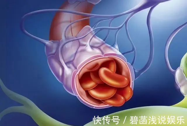 降血脂|血脂高不高,看脸上三个地方就知道,降血脂:四种食物一口别吃