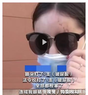 栓塞|爱美妈妈经常做的玻尿酸隆鼻,儿子才做1次竟然就“栓塞”了?