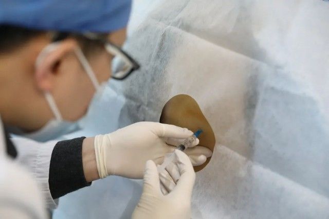 诺西那生钠|“天价药”实施医保首日:自费降至数千元