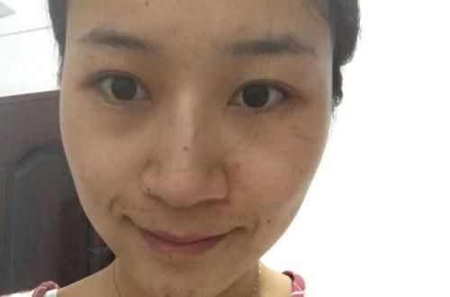 皮肤科主任：女人常吃4物，皮肤白皙，健康活力显年轻