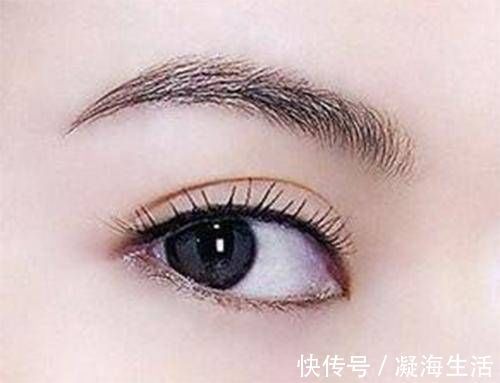 恢复期|美得有名堂｜什么样的双眼皮好看又适合自己，你知道吗？