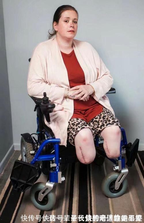 小宝宝|生下孩子醒来却发现自己的腿不见了!这是什么操作!