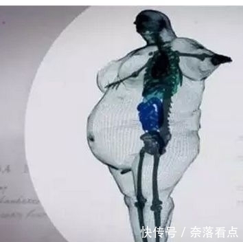 X光|“900斤”男子接受全身扫描,X光照片惊呆众人