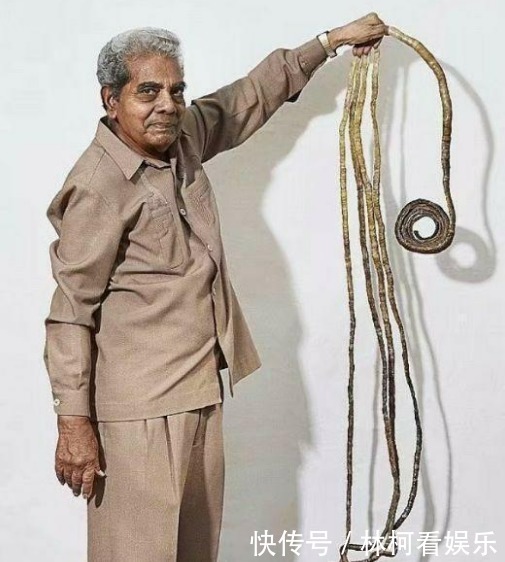 大爷剪掉留了44年长指甲,捐给博物馆,不料指甲剪掉后发生了变化