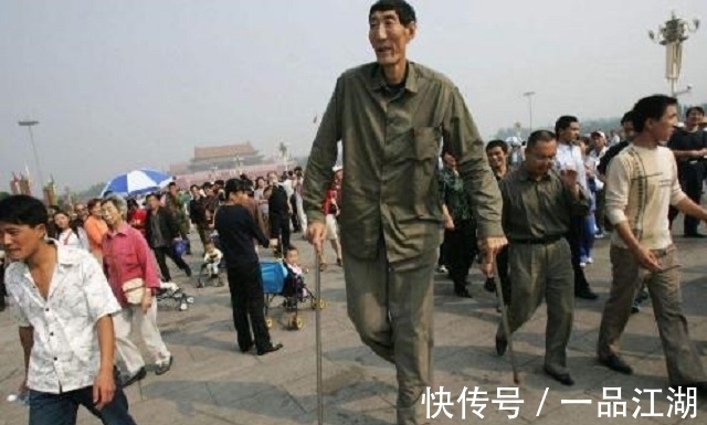 巨人症|世界第一高鲍喜顺,不听医生劝阻生孩子,儿子10岁时身高1.6米