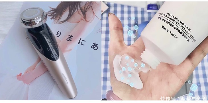 控制体重|别再花钱乱做无用功!有效预防妊娠纹就看这3点,生完好像没生过