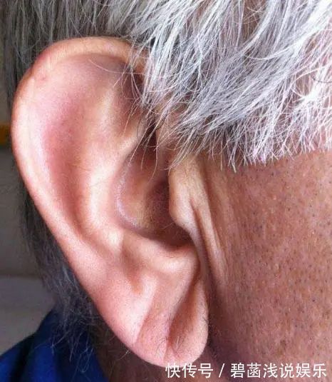 降血脂|血脂高不高,看脸上三个地方就知道,降血脂:四种食物一口别吃