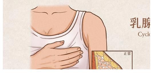 巧克力|吃一次等于10斤巧克力,很多人爱吃,医生:无知,都是自毁乳腺