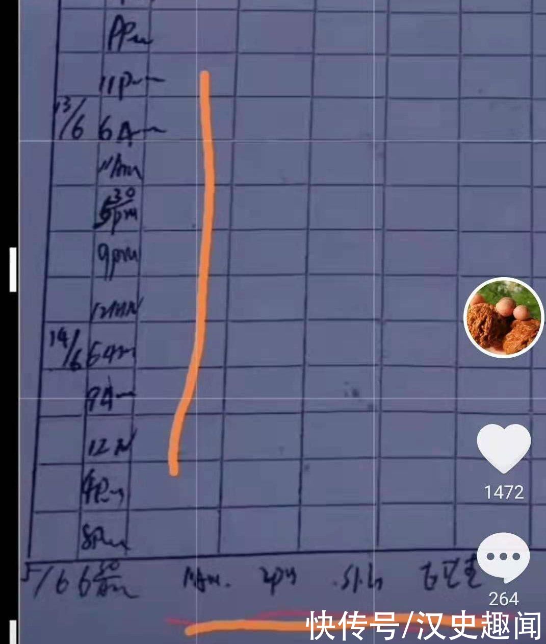 手术|郑引19号开的医嘱，18号提前被送去检验，假医嘱暴露孩子出生日期