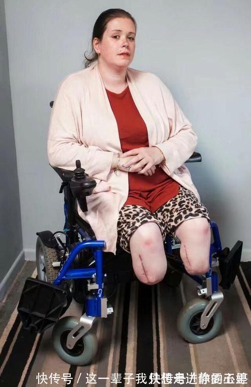 孩子|生下孩子醒来却发现自己的腿不见了!这是什么操作!