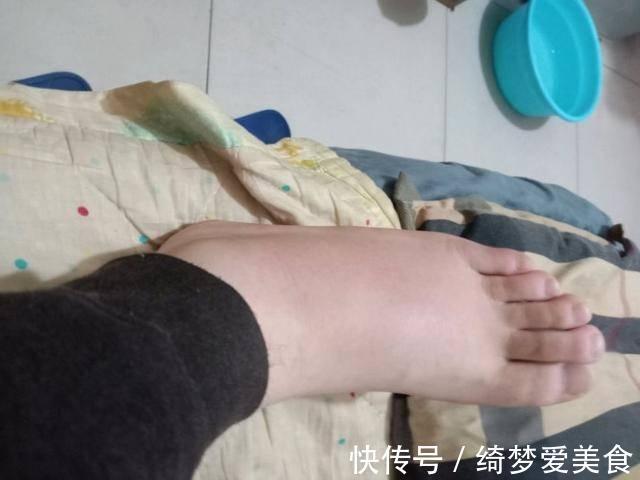 调理|男子仅用90天，尿酸从762降到337，他的经验或许对你有用