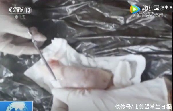 医院|网红小抽脂手术感染后死亡！违规整形带走多少女孩的生命