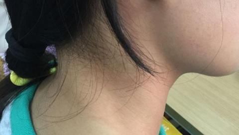 酸痛|脖子一扭动就咔咔响，是颈椎病捣乱吗？此2类人不可随意扭脖子