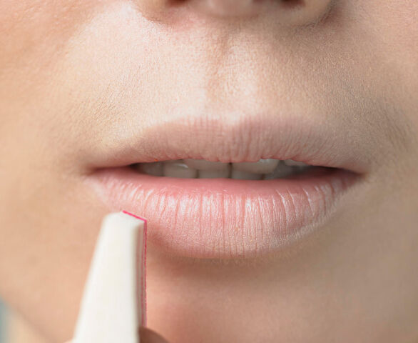 口角炎及注意事項