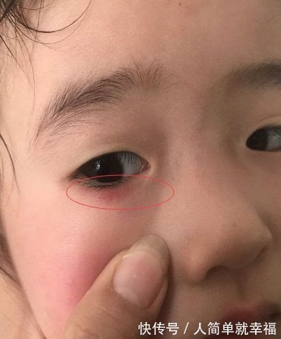 父母|14岁男孩身高已有183cm,儿科医生:4种食物是入秋“长高王”