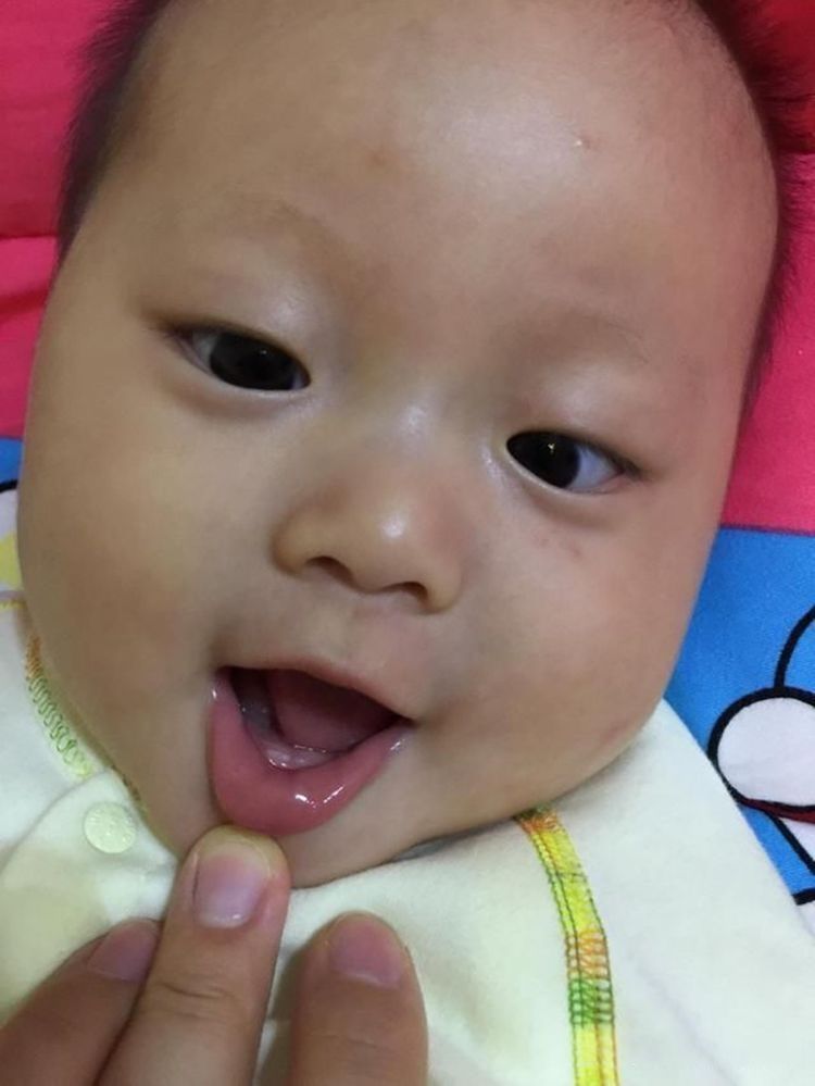 宝宝|女儿生下来就有“2颗牙齿”,婆婆说孩子命苦,儿科医生:拔掉吧