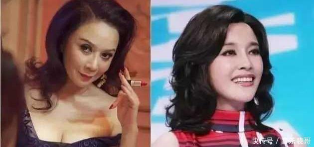 不老女神|还有多少女明星为了变美,而去饮鸩止渴打玻尿酸