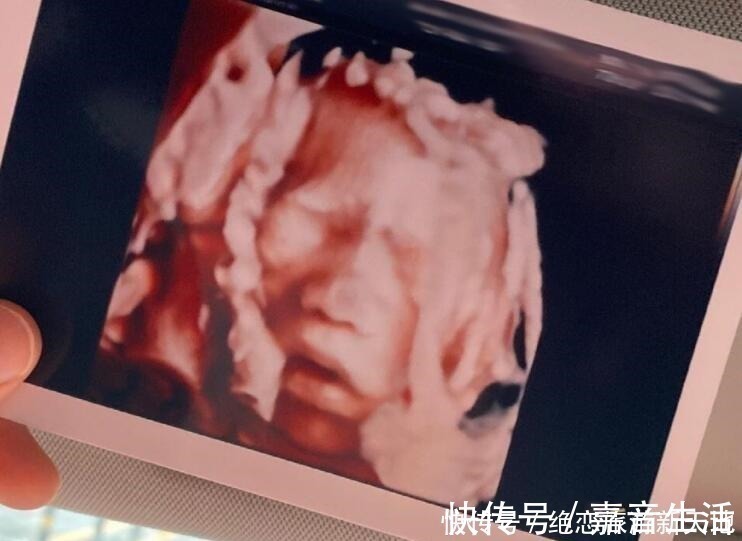 茄子状|四维彩超以为是女儿,生产时成功翻盘,孕期这些症状可能生儿子!