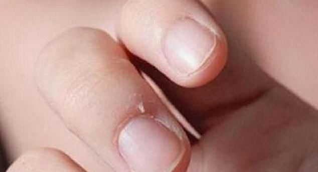 发育|孩子是不是缺锌,身上会有4个明显变化,家长们可不要疏忽了