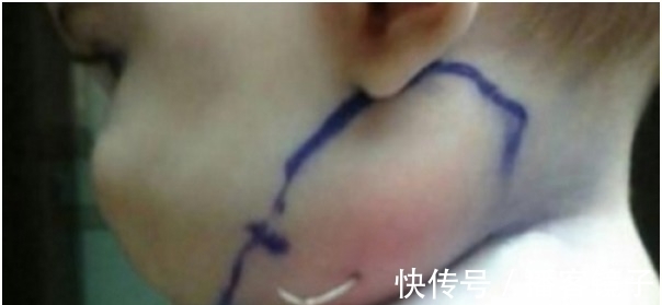女婴|父母带着脖子突出一根东西的女婴去医院　一往外拉连医生都吓傻