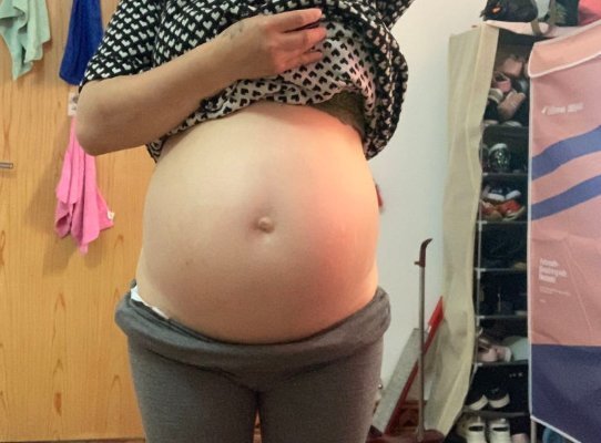 胎儿在宫内|准妈妈犯小错误,孕中期胎盘剥离,胎儿被引产