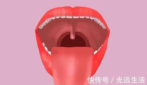 小孩子|孩子嘴里气味难闻,检查发现长了结石!告诉你,它是怎么来的