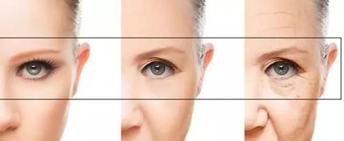 解救“大龄”眼周问题，这篇给你一次搞定