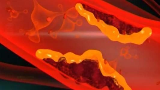 经常吃花生，对血管是保护还是伤害三种错误吃法对身体没好处