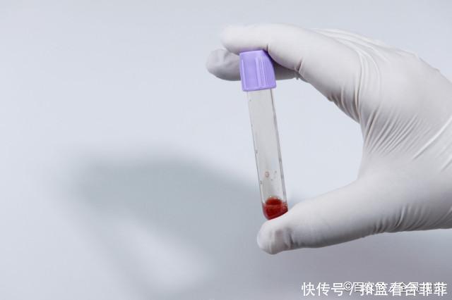 大鱼大肉|大鱼大肉并非高血脂真正“根源”,提醒:2物请趁早撤下饭桌