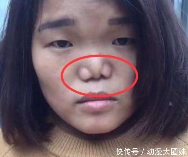 鼻子|被公认的3种“丑鼻子”,中了颜值不会太高,没中的小仙女偷笑吧