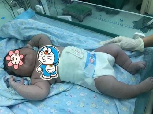 胎位|宝宝脸上产钳印难消，婆婆抱怨儿媳没本事，儿媳一句话回怼太解气