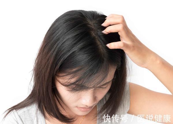 清洁|头皮经常长痘痘,这6个因素脱不了关系,4个方法或能帮你缓解