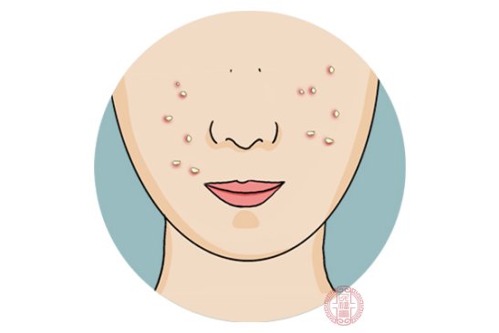 怎么样去黑头痘痘