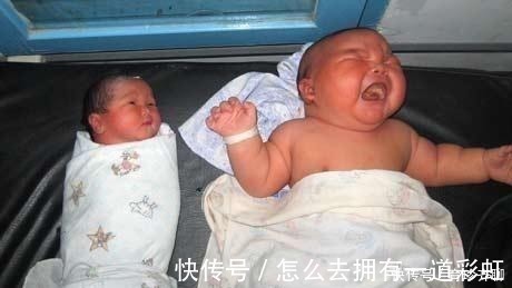 糖尿病|41岁高龄产妇竟产下17斤巨婴, 巨宝宝胃口更是大得让人咂舌