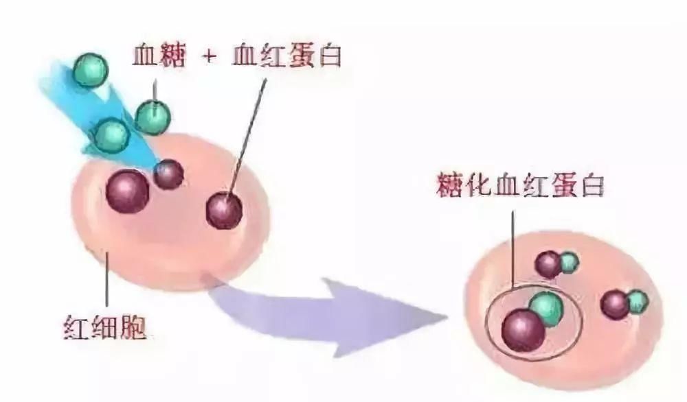 糖化血红蛋白|重磅糖尿病降糖标准变了,你必须知道这些