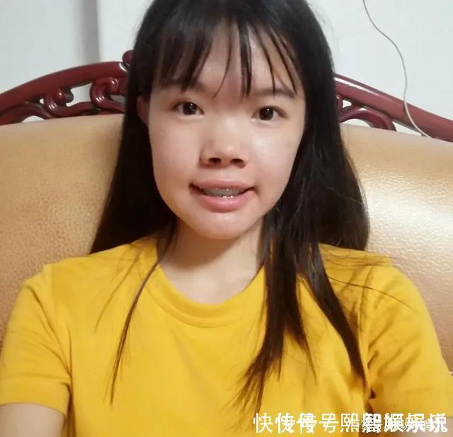 蒜头鼻|五种公认的“丑鼻型”,蒜头鼻、驼峰鼻都上榜了,第一个最常见