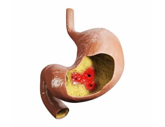 心血管|尿毒症不光会损伤肾,还会给这5大系统造成损伤,需引起重视