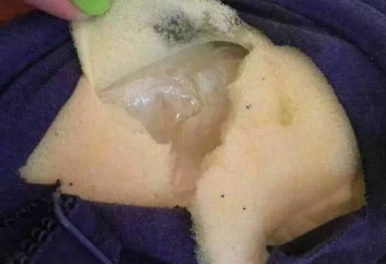 发痒|女孩身上发痒找不到原因,求助医生找不到问题,一把剪刀找到真相