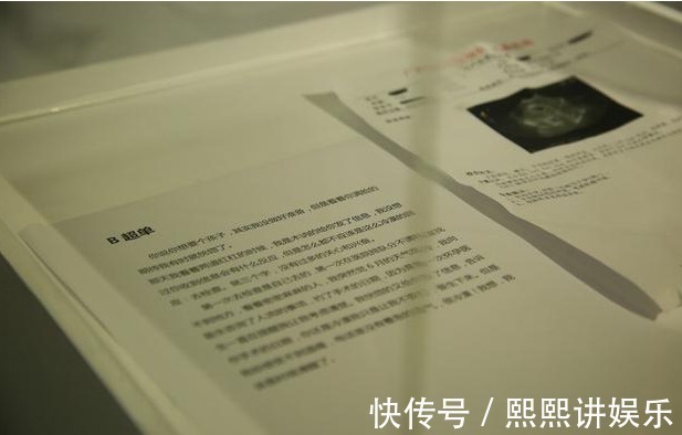 胎心|“胎心151，后壁，双肾未分离”，医生夸宝宝优秀，暗示啥