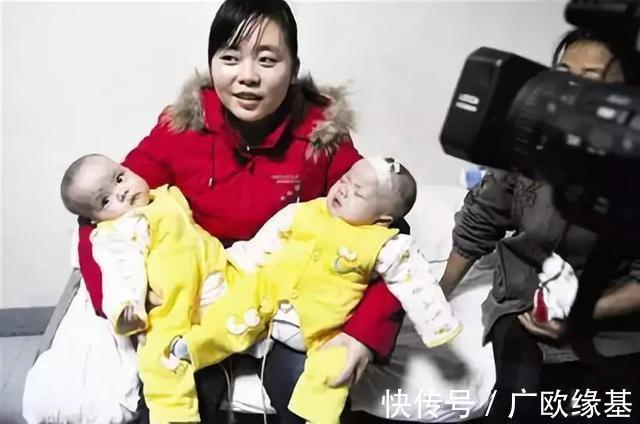 双胞胎|我国首例“坐骨连体”双胞胎,成功分开11年了,她们现在还好吗