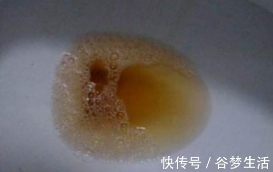 肝脏|肝不好的人,上厕所可能有以下3种现象,若没中,说明肝还不错