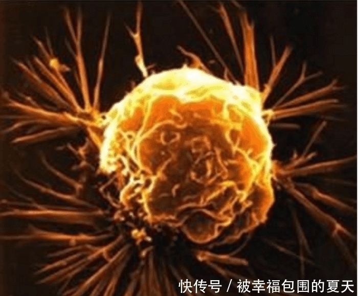 患有|女子死于中风,将器官捐献给5人,结果先后四人不幸中招