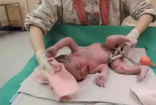 一组图带你了解:宝宝出生后,被医生抱走的神秘十分钟都经历了啥