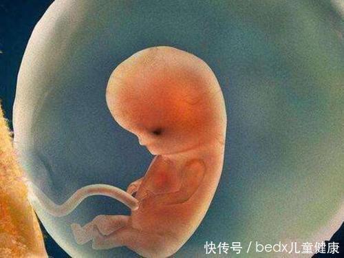 先天性|北斗星儿童健康——兔唇是什么原因造成的,如何预防兔唇