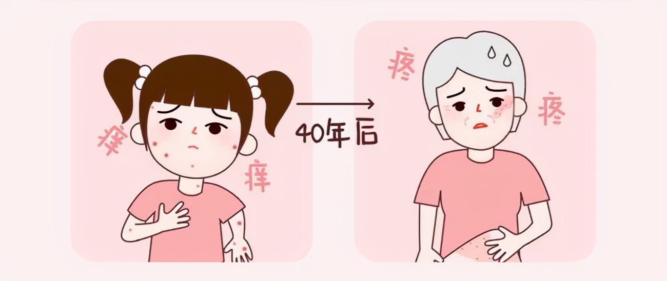 神经节|痛得要命！73岁阿姨脸上冒出连串的“北斗七星”，只因病毒深藏不露