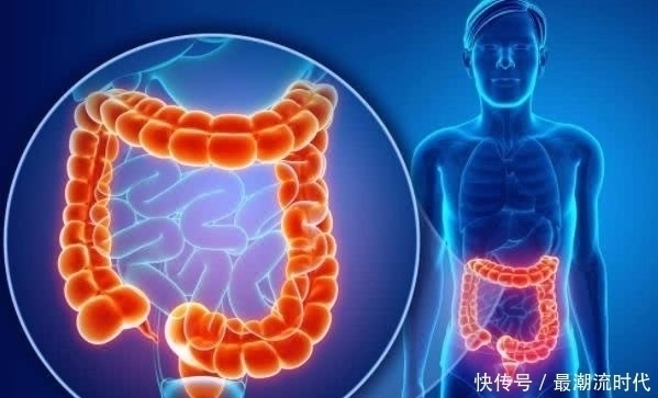 癌细胞|“肠癌”一经发现就是晚期?上厕所时,3个“情况”早预防