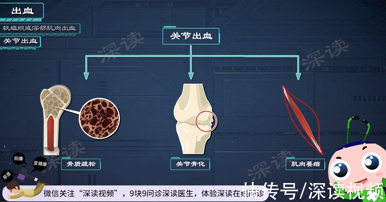 血友病|一碰就出血？出血难止住？让人脆弱不堪的血友病，都有啥症状？