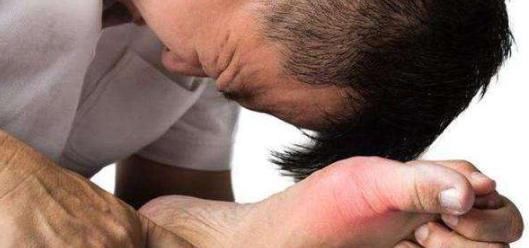 高手|3种“排酸高手”出现,家中常备,尿酸正常,痛风不敢靠近